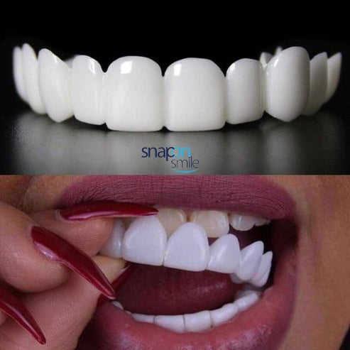 CARILLAS DENTALES- SONRISA PERFECTA